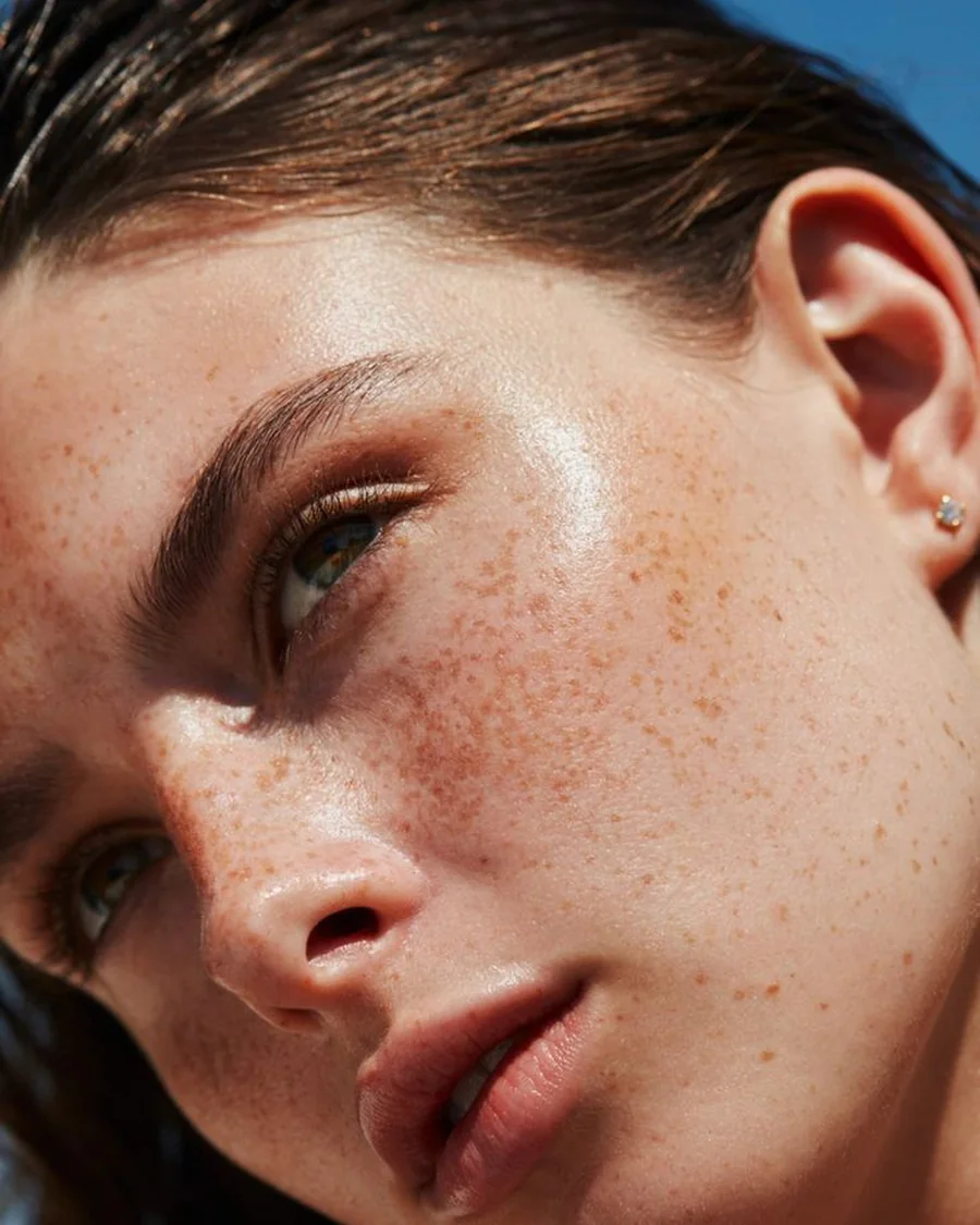 Sunlit close-up of a freckled woman's face